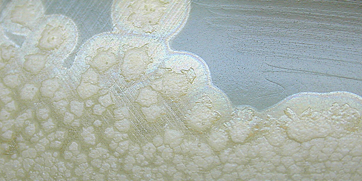 In Sardegna è morta un’altra donna per un’intossicazione da botulino: era fra le persone ricoverate dall’inizio di agosto