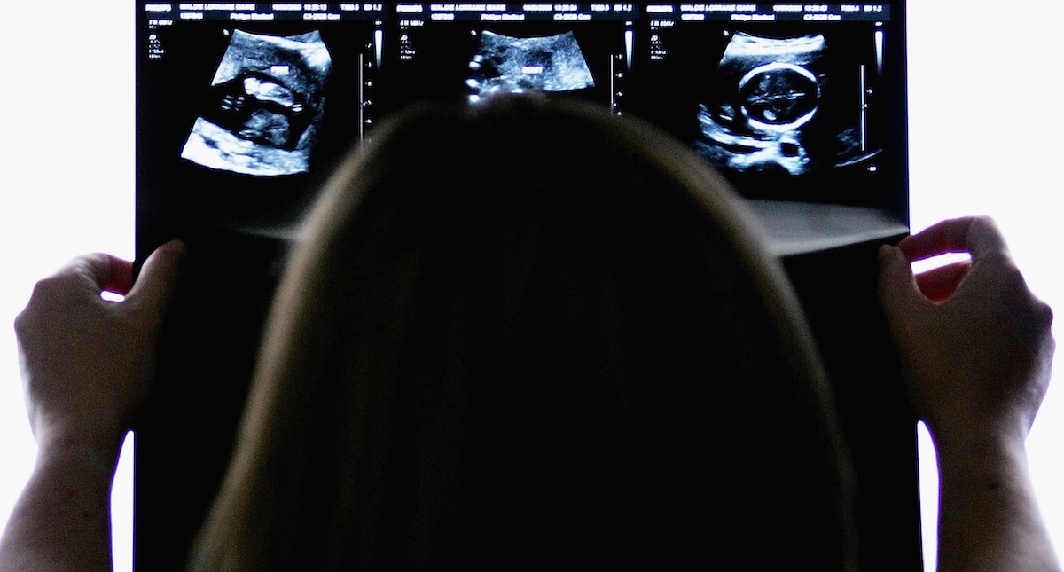 Non sapere di essere incinte, fino al parto