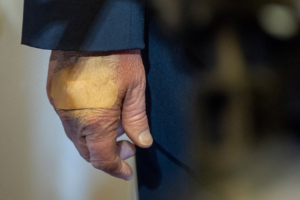 La mano destra di Trump con un cerotto, in una foto del 30 novembre 
