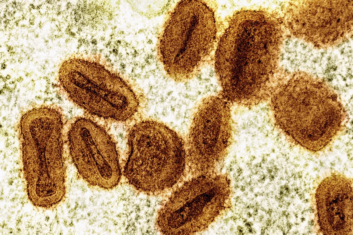 L’mpox, la malattia che era nota come “vaiolo delle scimmie”, non è più un’emergenza sanitaria in Africa