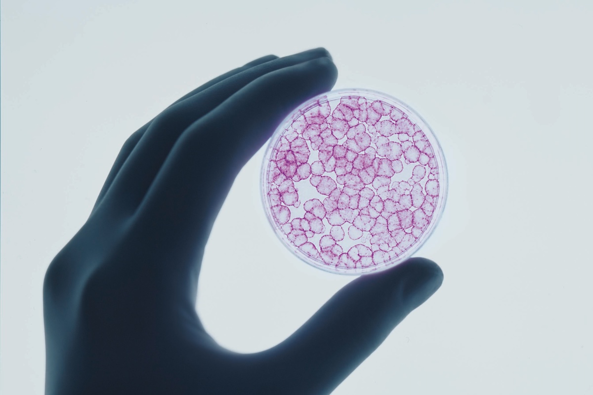 Il centro di ricerca avanzato che curava i “bambini farfalla” è quasi fermo