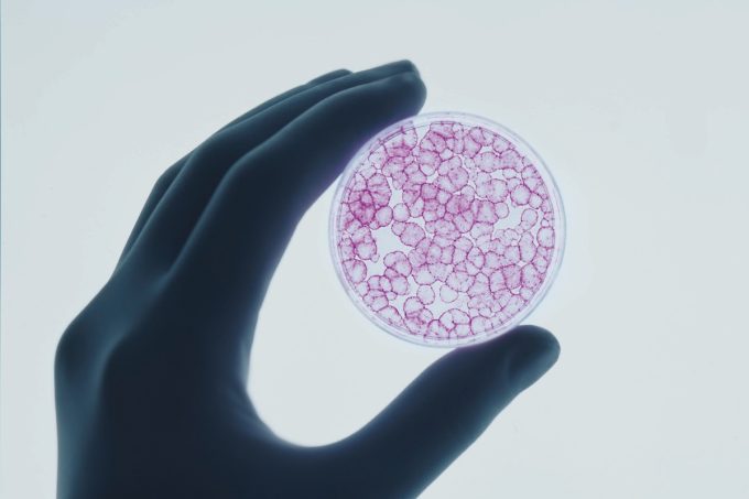 Il centro di ricerca avanzato che curava i “bambini farfalla” è quasi fermo