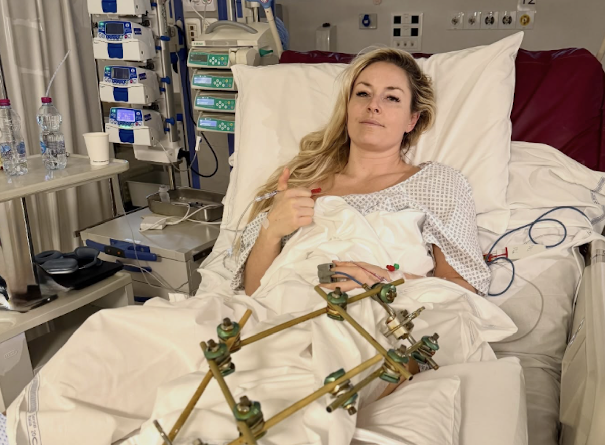 La prima foto della sciatrice statunitense Lindsey Vonn dopo il suo infortunio
