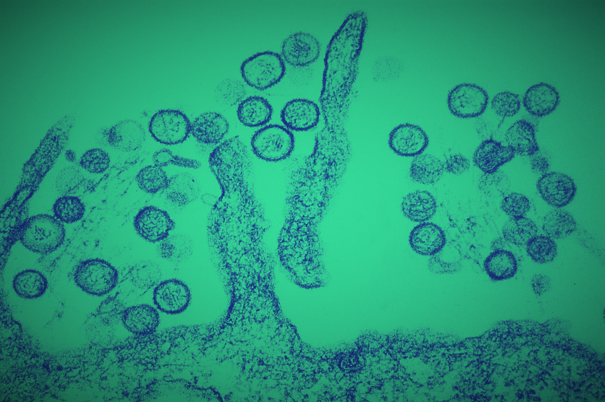 Dov’erano gli hantavirus prima che li scoprisse tutto il mondo