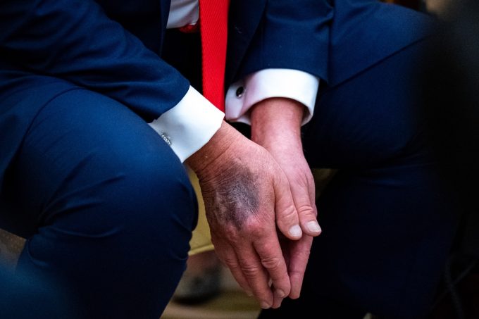 Perché preferiamo una mano all’altra?