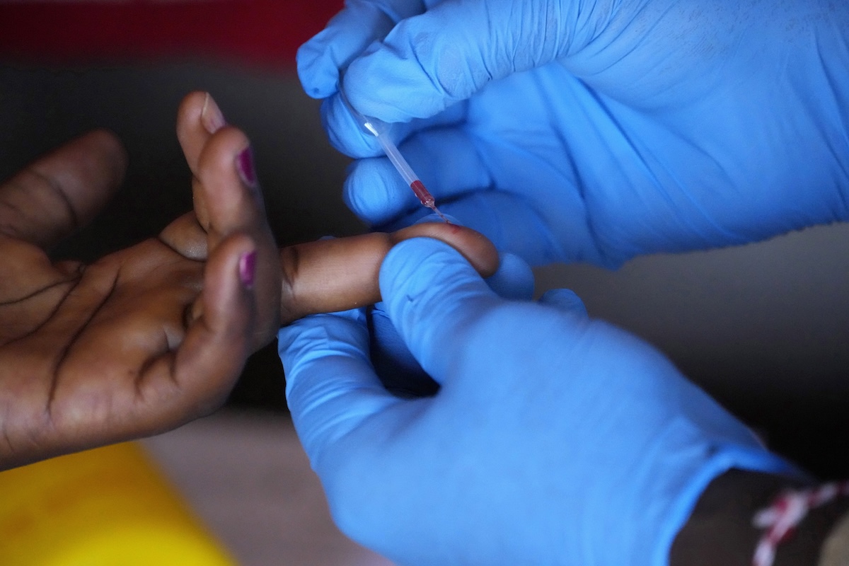 Gli Stati Uniti smetteranno di finanziare i programmi per contrastare la diffusione dell’HIV in Sudafrica