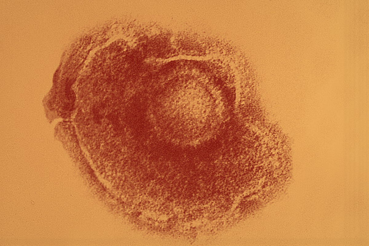 Il vaccino contro l’herpes zoster aiuta a prevenire la demenza?